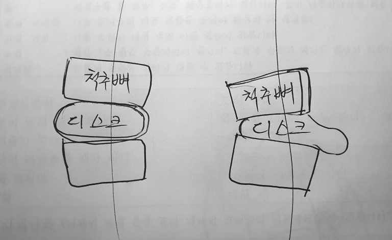 광진경희한의원 | 상체 광진경희한의원|상체