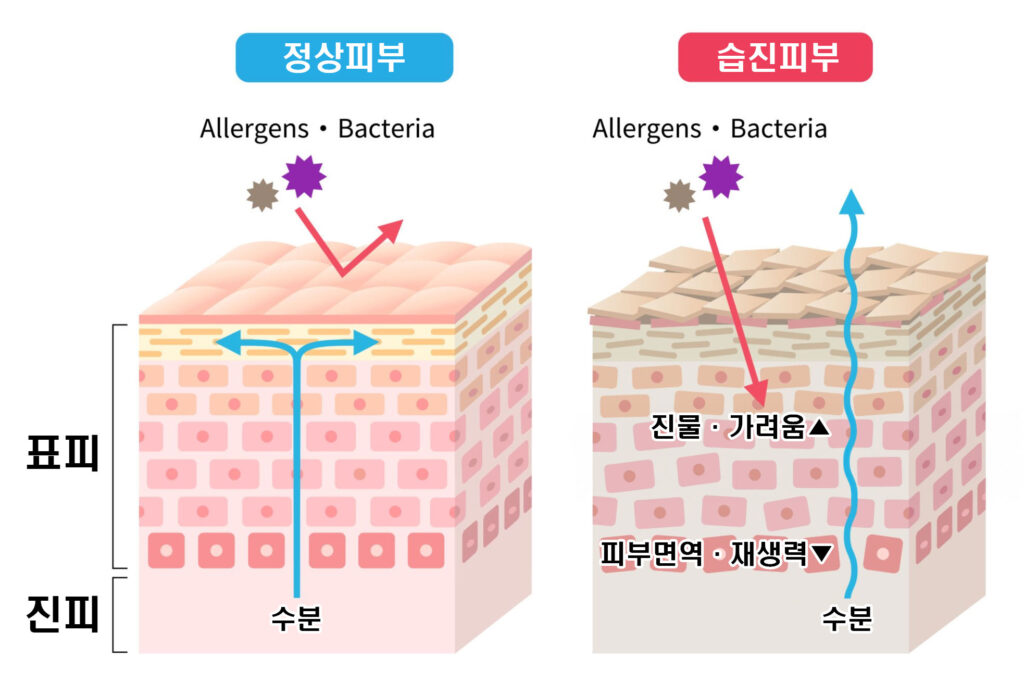 광진경희한의원 | 서울화폐상습진한의원