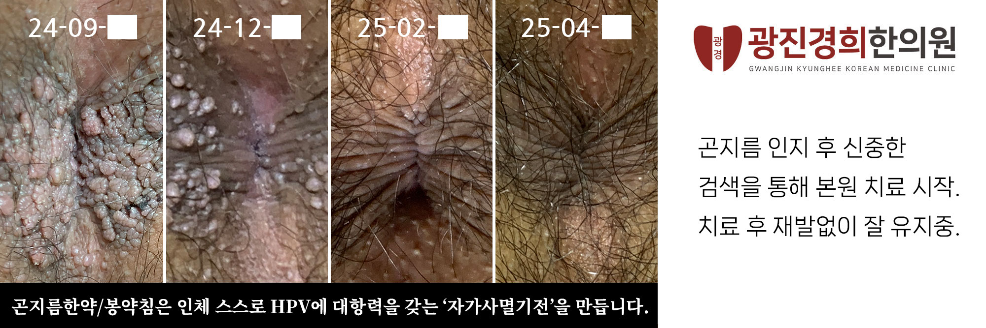 광진경희한의원 | 서울곤지름병원 광진경희한의원|서울곤지름병원