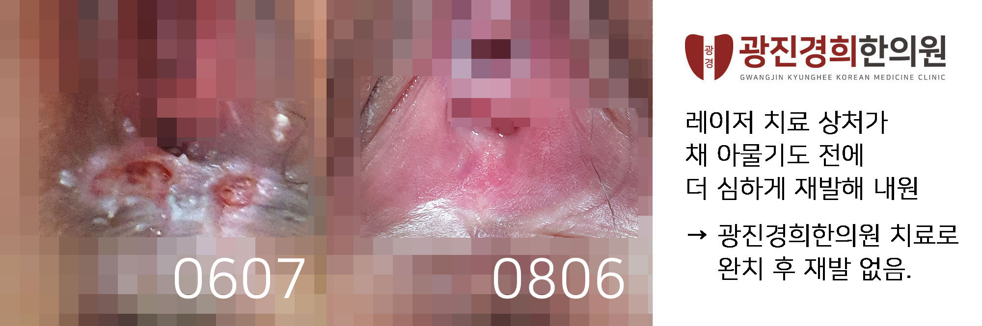 광진경희한의원 | 서울곤지름병원 광진경희한의원|서울곤지름병원